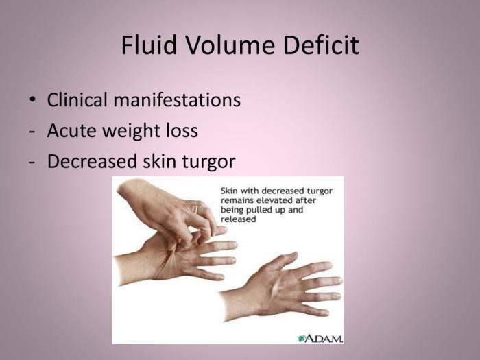 Fluid deficit